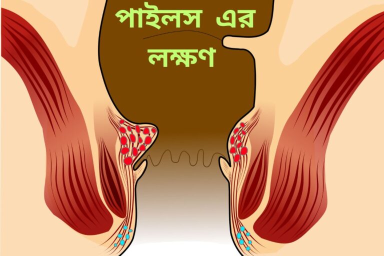 Symptoms of piles
