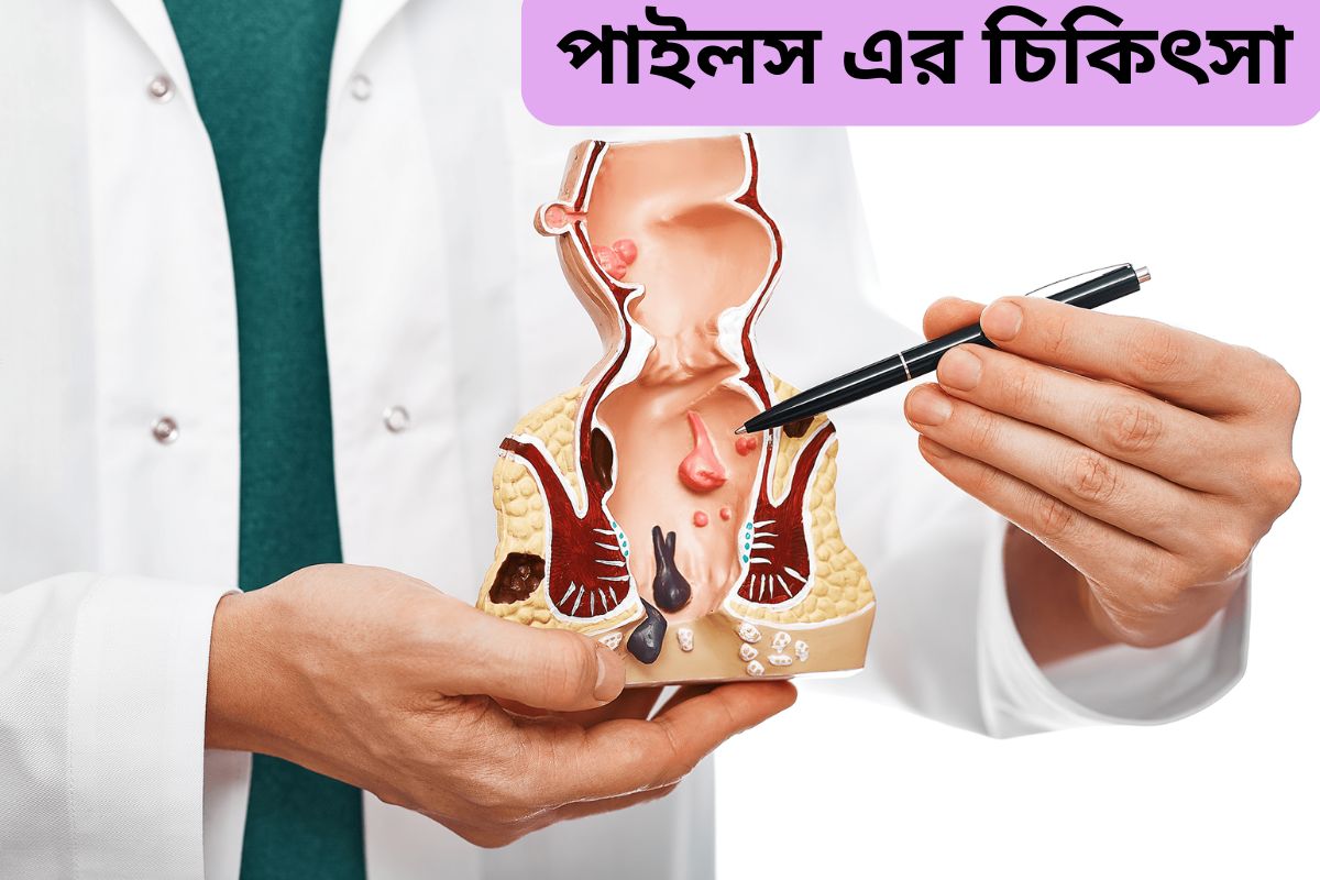 Treatment of piles