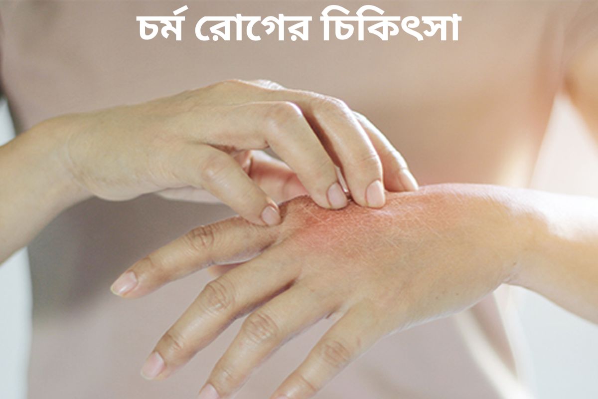 Treatment of skin diseases