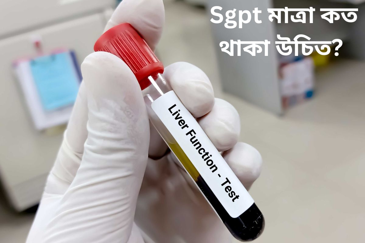 What should be the Sgpt level