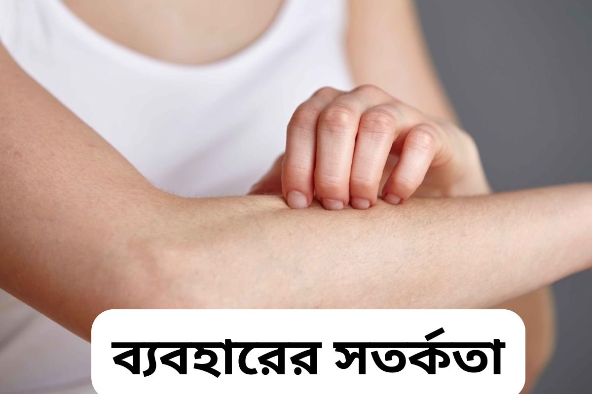 Pevisone Cream side effect