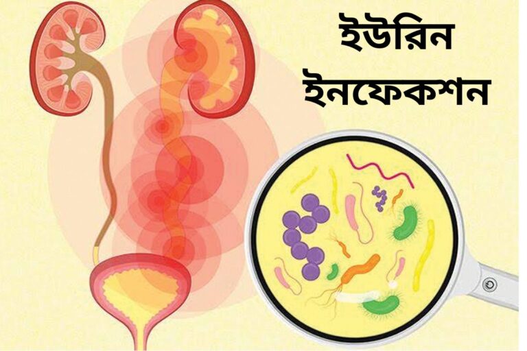 Urine infection